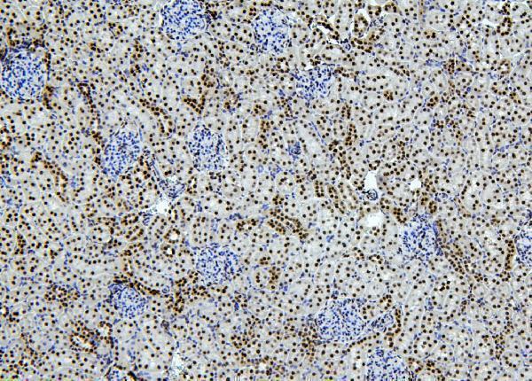 a01798 ptbp1 primary antibodies ihc testing 6