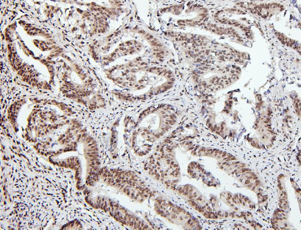 a01798 ptbp1 primary antibodies ihc testing 7