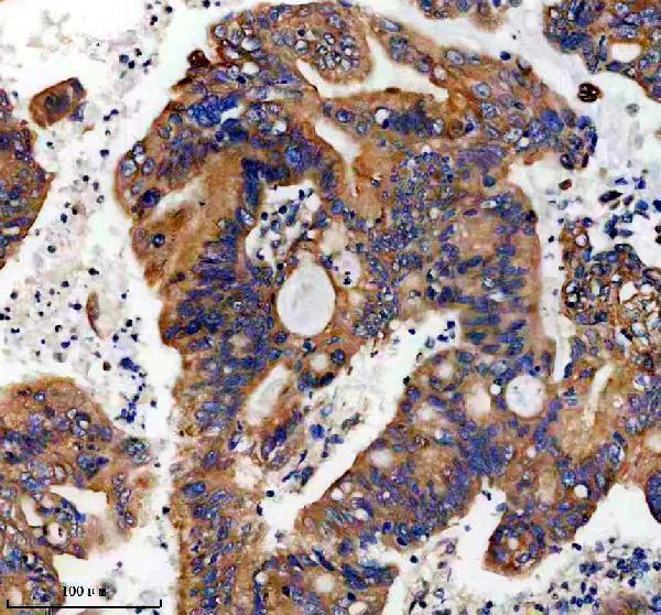 IHC analysis of PNPLA2 using anti-PNPLA2 antibody (A01800-1)