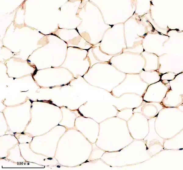 IHC analysis of PNPLA2 using anti-PNPLA2 antibody (A01800-1)