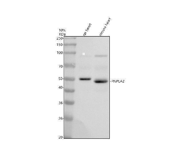 Western blot analysis of PNPLA2 using anti-PNPLA2 antibody (A01800-1)