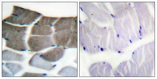 Immunohistochemistry analysis of paraffin-embedded human skeletal muscle tissue, using ACC1 Antibody
