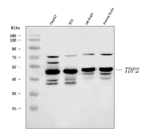  Western blot analysis of TDP2 using anti-TDP2 antibody (A01804-1)