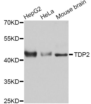 Western blot analysis of extracts of various cell lines, using TDP2 Antibody at 1:3000 dilution