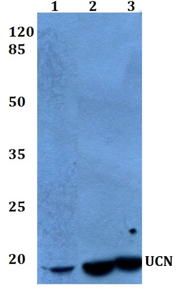 Western blot (WB) analysis of UCN (A103) polyclonal antibody at 1:500 dilution
Lane1:HEK293T whole cell lysate
Lane2:sp2/0 whole cell lysate
Lane3:PC12 whole cell lysate