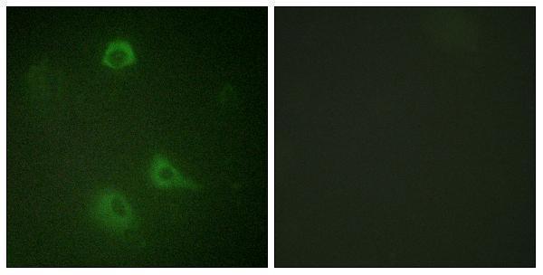 Immunofluorescence analysis of A549 cells, using NMDAR1 (Phospho-Ser890) Antibody