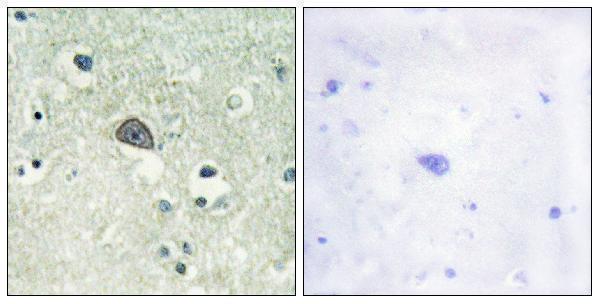 Immunohistochemistry analysis of paraffin-embedded human brain, using NMDAR1 (Phospho-Ser890) Antibody