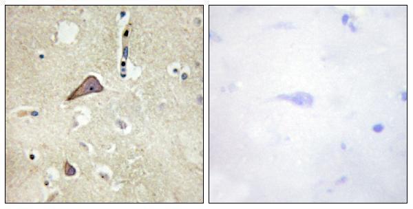 a01808s896 1 grin1 primary antibodies ihc testing 4