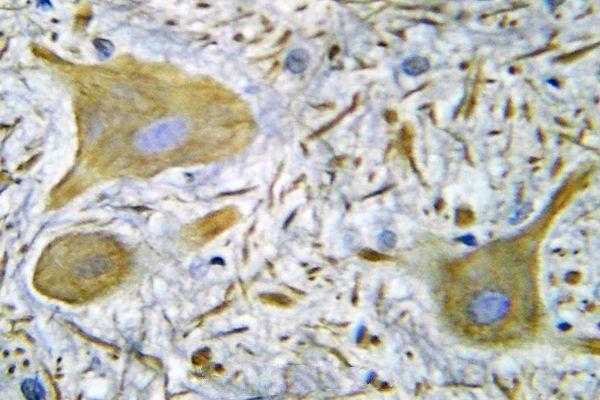 Immunohistochemistry (IHC) analyzes of NMDAR1 (S902) pAb in paraffin-embedded human spinal cord tissue