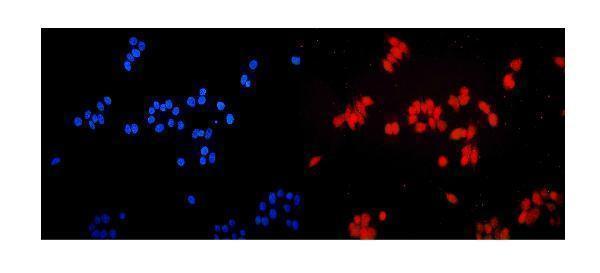 a01809 2 etv5 primary antibodies if testing 2