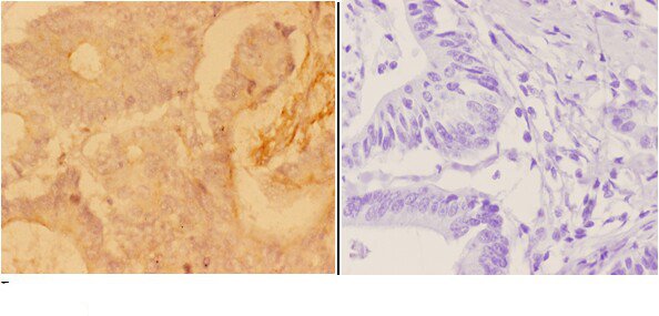 a01810 1 adarb1 primary antiboties ihc testing 2
