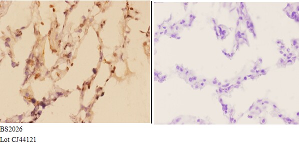 a01810 1 adarb1 primary antiboties ihc testing 3