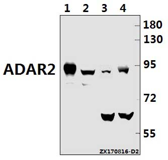 a01810 1 adarb1 primary antiboties wb testing 1