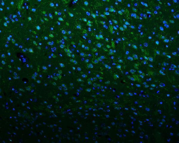 a01813 1 kcna1 primary antibodies if testing 4