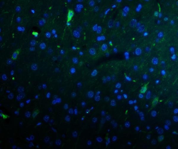IF testing of KCNA1 primary antibodies