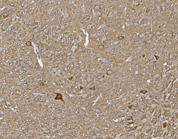  IHC analysis of KCNA1 using anti-KCNA1 antibody (A01813-1)