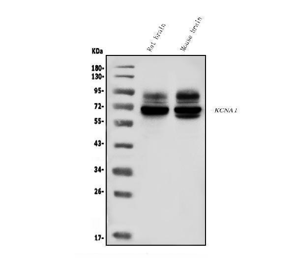 Western blot analysis of KCNA1 using anti-KCNA1 antibody (A01813-1)
