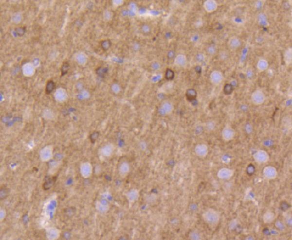 a01813 2 kcna1 primary antiboties ihc testing 2