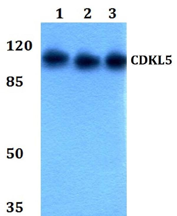 Western blot (WB) analysis of CDKL5 polyclonal antibody at 1:500 dilution
Lane1:HEK293Twhole cell lysate
Lane2:Raw264