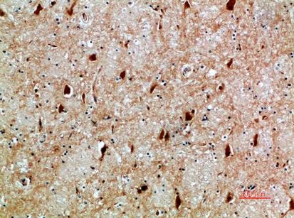a01815 1 nfat5 primary antibodies ihc testing 1