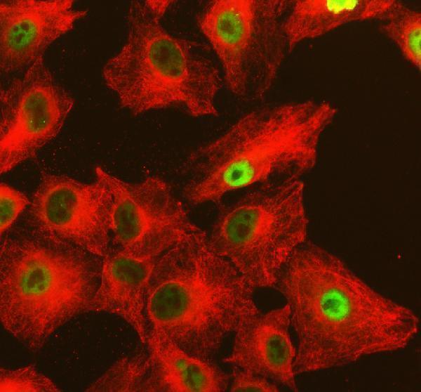 a01815 3 nfat5 primary antibodies if testing 1
