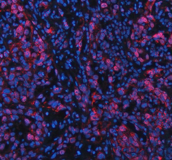 a01815 3 nfat5 primary antibodies if testing 2