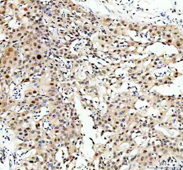 IHC analysis of NFAT5 using anti-NFAT5 antibody (A01815-3)