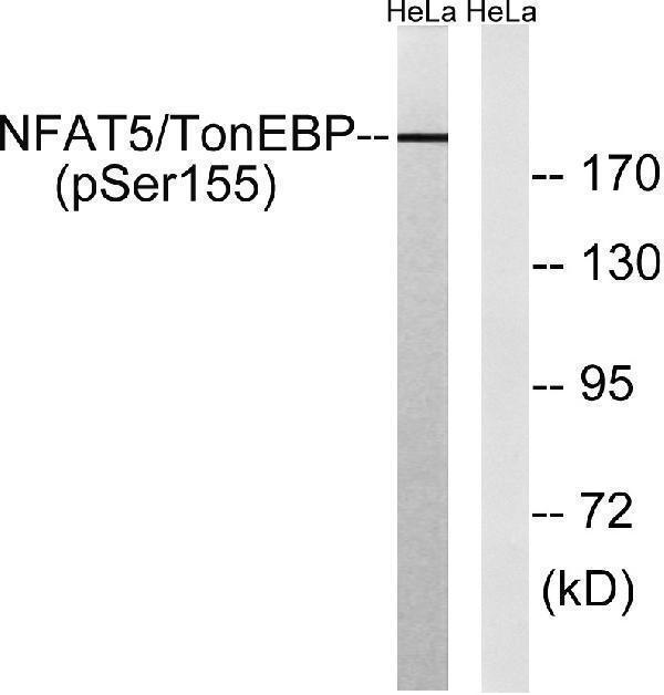 Western blot analysis of lysates from HeLa cells treated with forskolin 40nM 30', using NFAT5/TonEBP (Phospho-Ser155) Antibody
