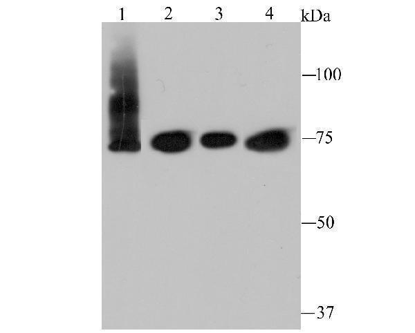 a01816 1 ikbke primary antiboties wb testing 1