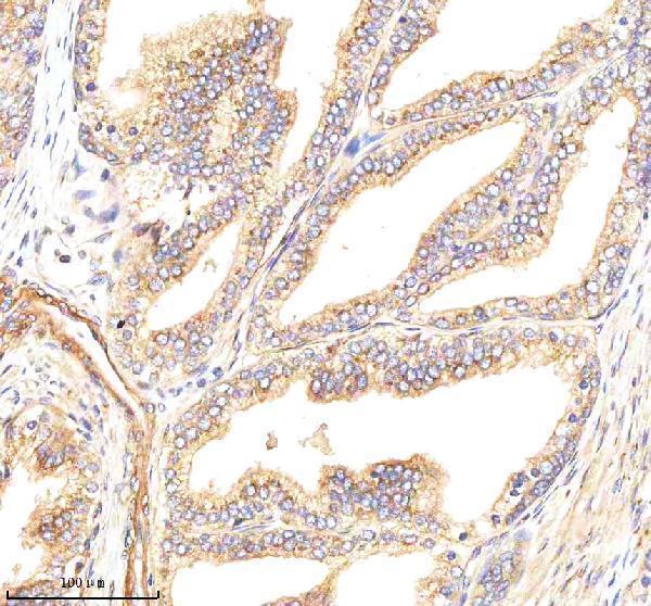  IHC analysis of GBF1 using anti-GBF1 antibody (A01817-1)