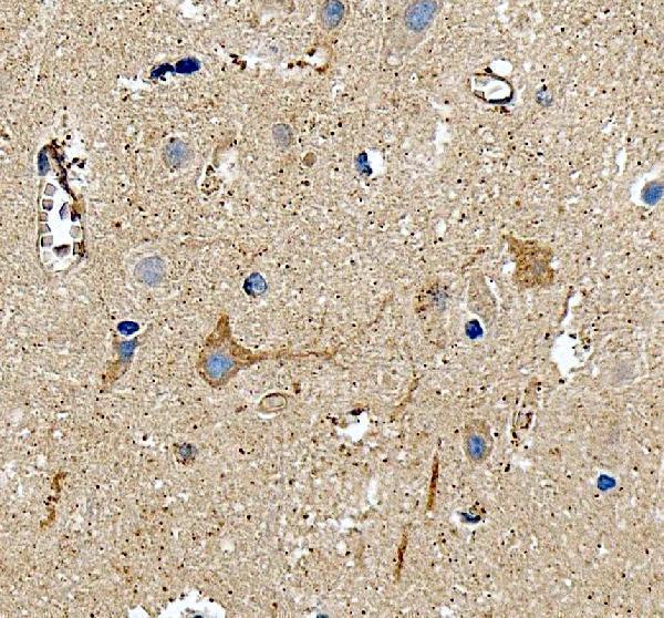 a01818 1 thy1 primary antibodies ihc testing 1