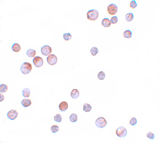 Immunocytochemistry of FOXO4 in HeLa cells with FOXO4 antibody at 10 μg/mL