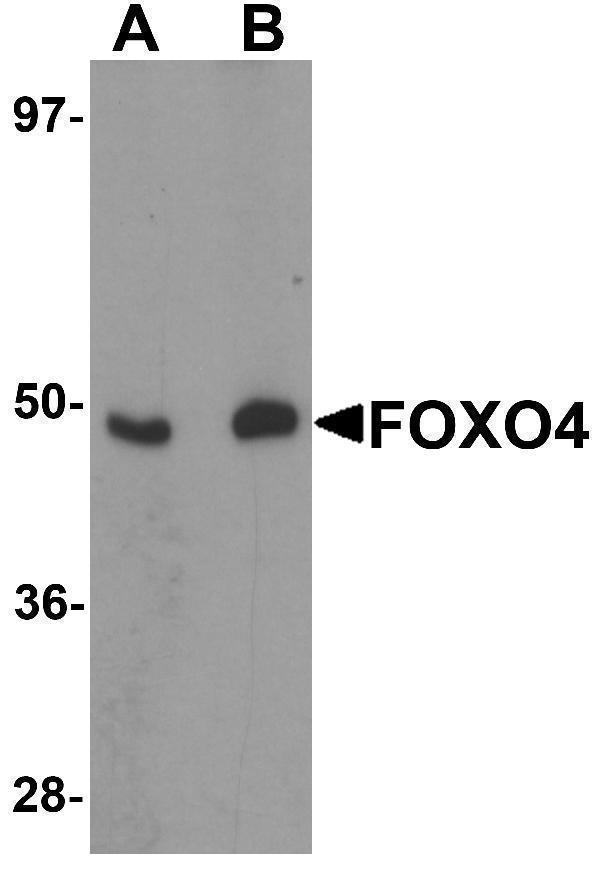 Western blot analysis of FOXO4 in HeLa cell lysate with FOXO4 antibody at (A) 0