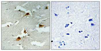 Immunohistochemical analysis of paraffin-embedded Human brain
