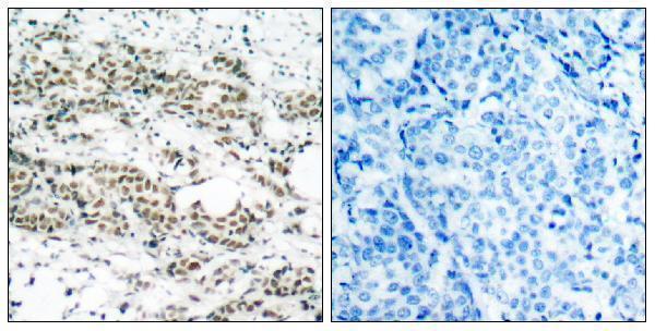 a01819s197 1 foxo4 primary antibodies ihc testing 5