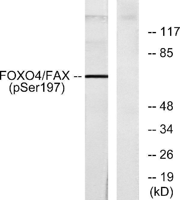 Western blot analysis of lysates from 293 cells treated with serum, using AFX (Phospho-Ser197) Antibody