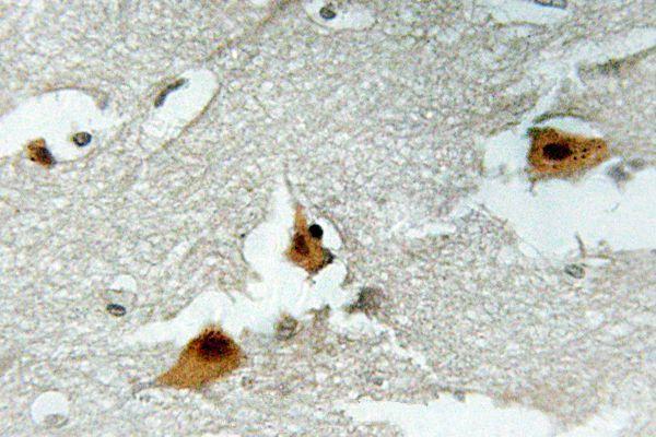 Immunohistochemistry (IHC) analyzes of p-FOXO4 (S197) pAb in paraffin-embedded human brain tissue