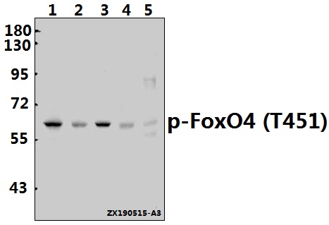 Western blot (WB) analysis of p-FoxO4 (T451) pAb at 1:500 dilution
Lane1:HEK293T whole cell lysate(40ug)
Lane2:HepG2 whole cell lysate(40ug)
Lane3:A549 whole cell lysate(40ug)
Lane4:H9C2 whole cell lysate(40ug)
Lane5:AML-12 whole cell lysate(40ug)