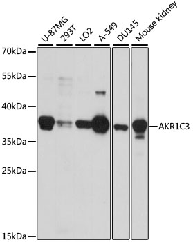 a01820 akr1c3 primary antiboties wb testing 1