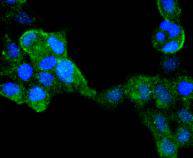 ICC staining IRF6 in 293 cells (green)