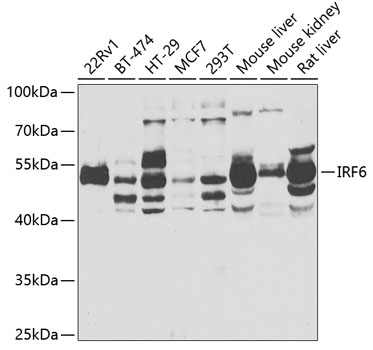 Western blot analysis of extracts of various cell lines, using IRF6 antibody  at 1:1000 dilution