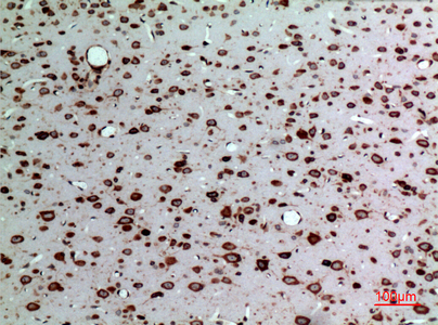 Immunohistochemical analysis of paraffin-embedded rat-brain, antibody was diluted at 1:100