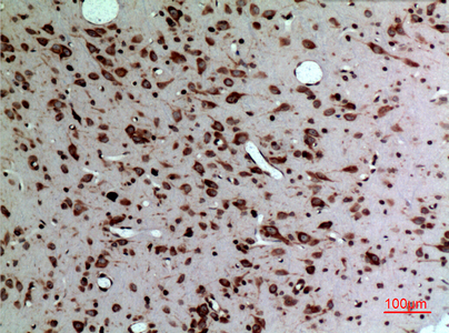 Immunohistochemical analysis of paraffin-embedded rat-brain, antibody was diluted at 1:100