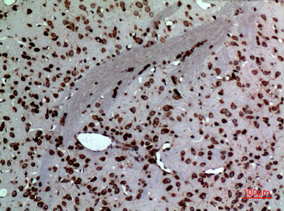 a01823 2 mdk primary antibodyes ihc testing 4