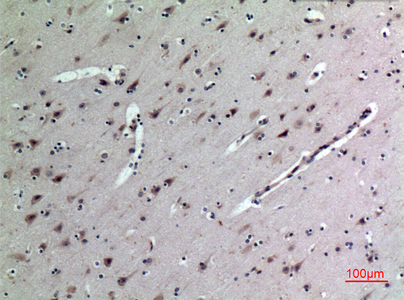 a01823 2 mdk primary antibodyes ihc testing 5