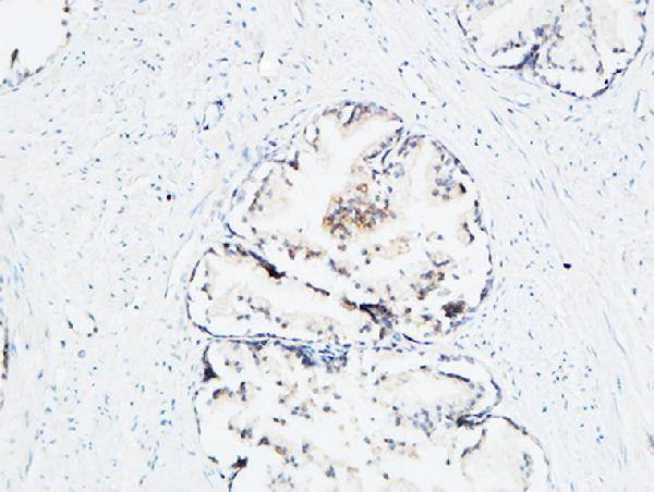 a01823 2 mdk primary antibodyes ihc testing 6