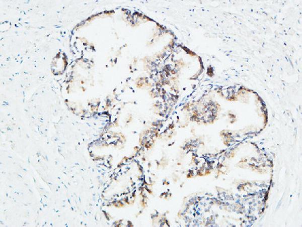 a01823 2 mdk primary antibodyes ihc testing 7