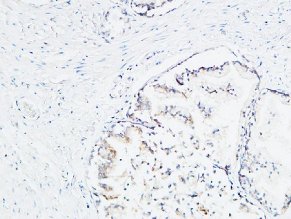 a01823 2 mdk primary antibodyes ihc testing 9