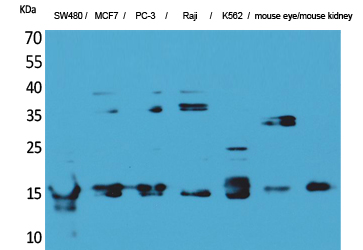 Immunohistochemical analysis of paraffin-embedded Human Prostate