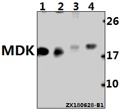 Western blot (WB) analysis of MDK (D143) pAb at 1:500 dilution
Lane1:A375 whole cell lysate(40ug)
Lane2:HCT116 whole cell lysate(40ug)
Lane3:CT26 whole cell lysate(40ug)
Lane4:The Testis tissue lysate of Rat(40ug)